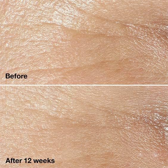 Before. After 12 weeks.